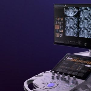 Voluson Signature 18