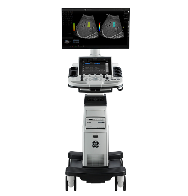 LOGIQ™ P9 XDclear™