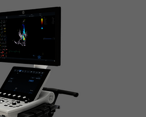 Vivid™ S70N Ultra Edition